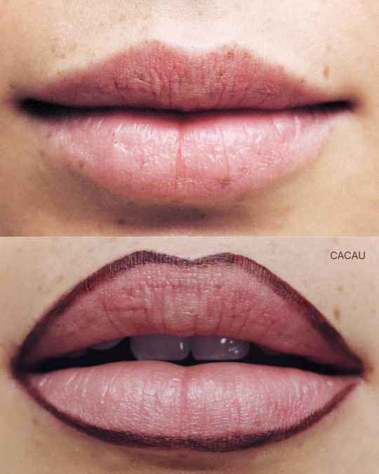 LAPISEIRA LABIAL  CACAU