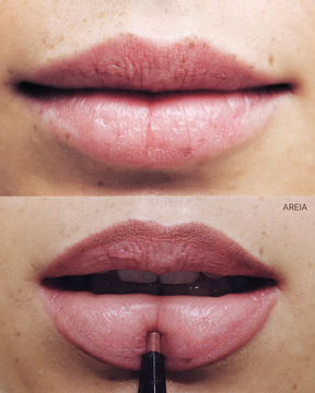 LAPISEIRA LABIAL AREIA